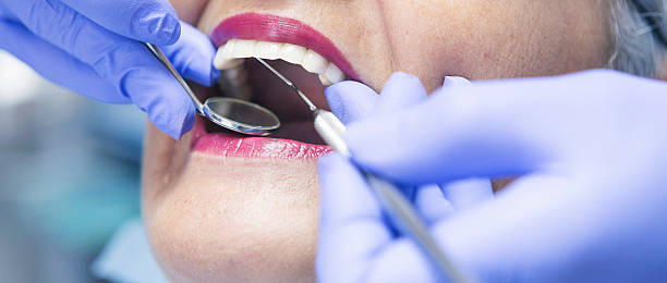 Best Emergency Root Canal Treatment in Boalsburg, PA